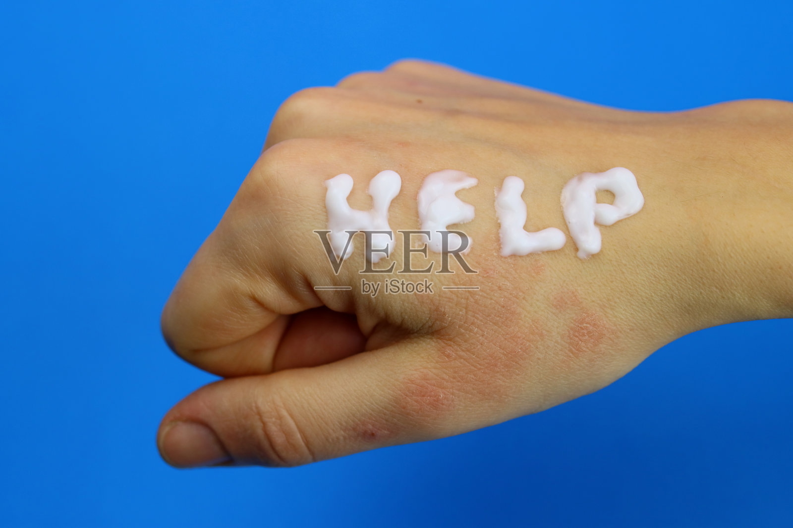 Word Help霜适用于生病的手，干燥的皮肤，真菌，皮疹，斑点或过敏照片摄影图片