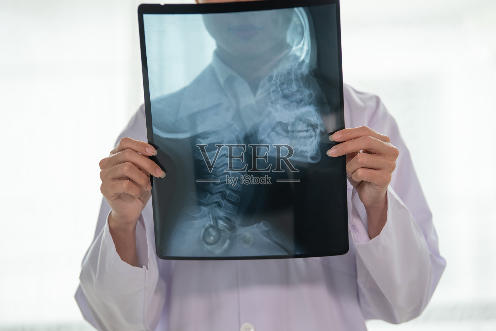 亚洲女医生向病人展示x光结果，颈椎椎体，保健和医疗概念照片摄影图片