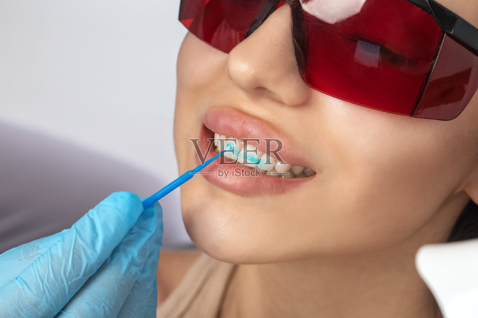 牙医在诊所给一位年轻漂亮的女士做牙齿美白手术。一个健康的微笑。照片摄影图片