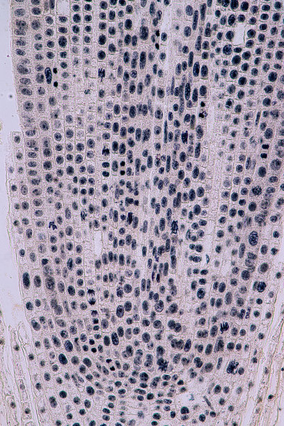 洋葱根尖和根尖有丝分裂细胞的显微镜观察图片